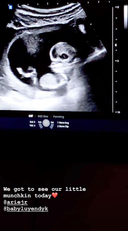 The Bachelor's Arie and Lauren Reveal Pregnancy Detail During Sonogram