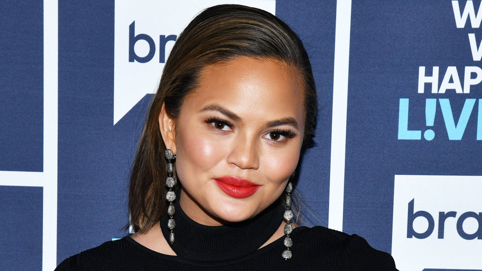 Chrissy Teigen Shows Off Her ‘Thigh Hives’ and ‘Fun’ Stretch Marks