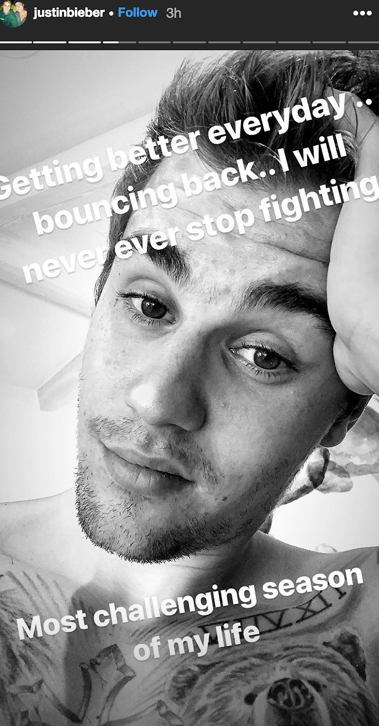 Justin Bieber Instagram Story Bouncing Back