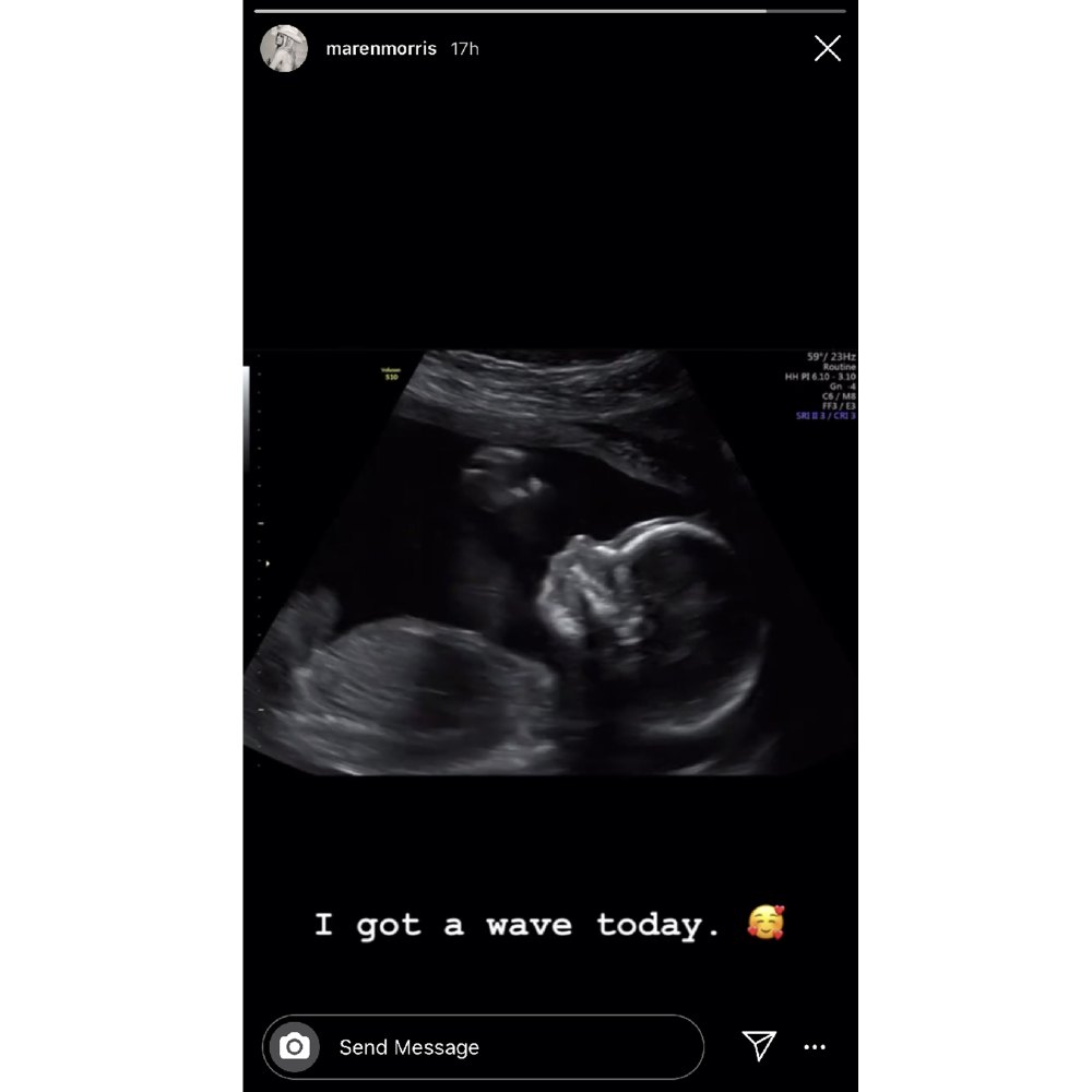 Pregnant Maren Morris Gets ‘a Wave’ From Baby Boy in Sonogram Video