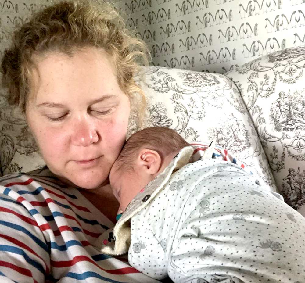 Amy Schumer’s ‘Really Scary’ C-Section Took 3 Hours