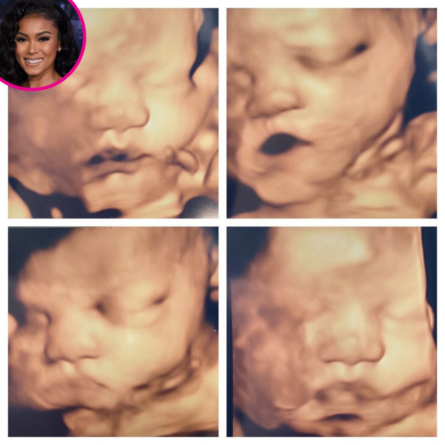 Eniko Parrish More Pregnant Stars Show Ultrasound Pics