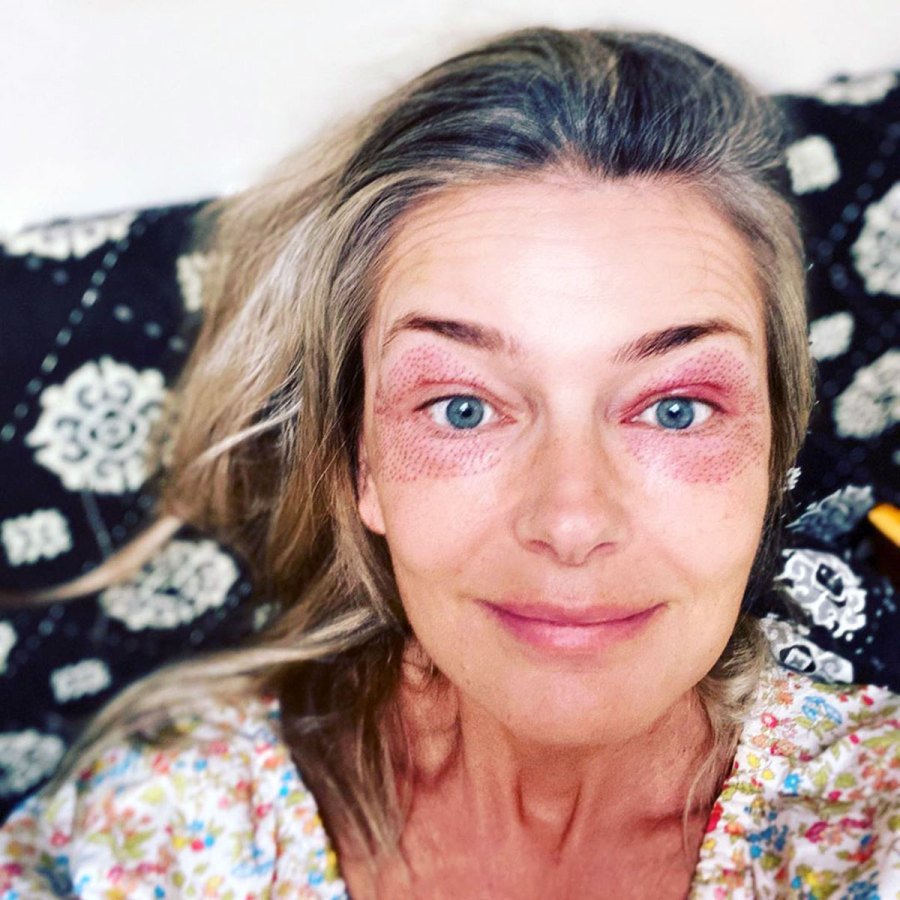 Paulina Porizkova Looks 'Freaky' After Getting 2 Skin Treatments
