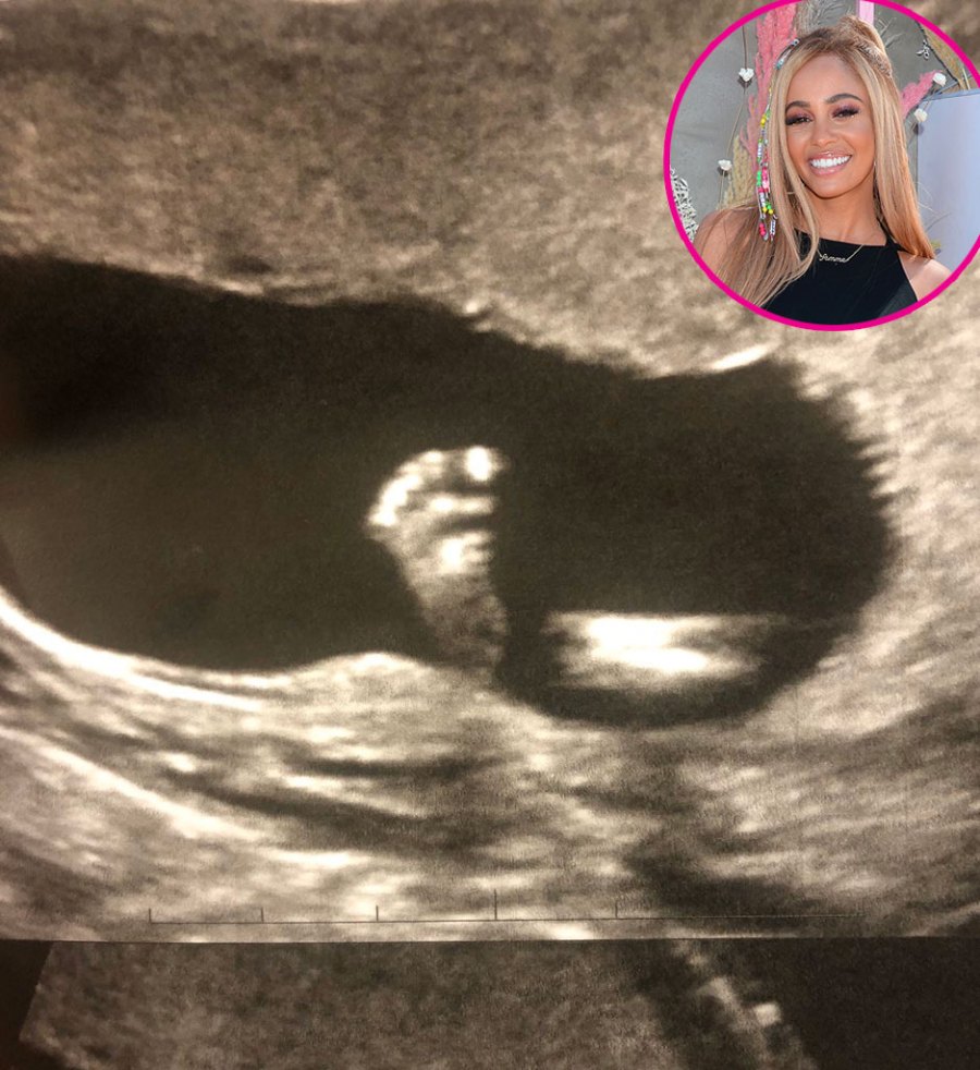 Vanessa Morgan Pregnant Stars Share Ultrasound Pics