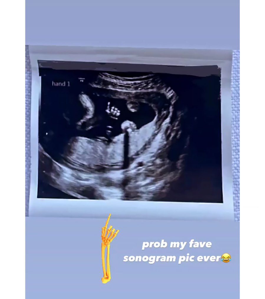 Giving Glimpses! Bachelor's Lesley Anne Murphy, More Stars' Ultrasound Pics