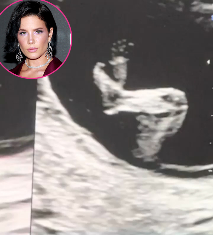 Halsey Pregnant Stars Share Ultrasound Pics: Vanessa Morgan, Lindsay Arnold and More