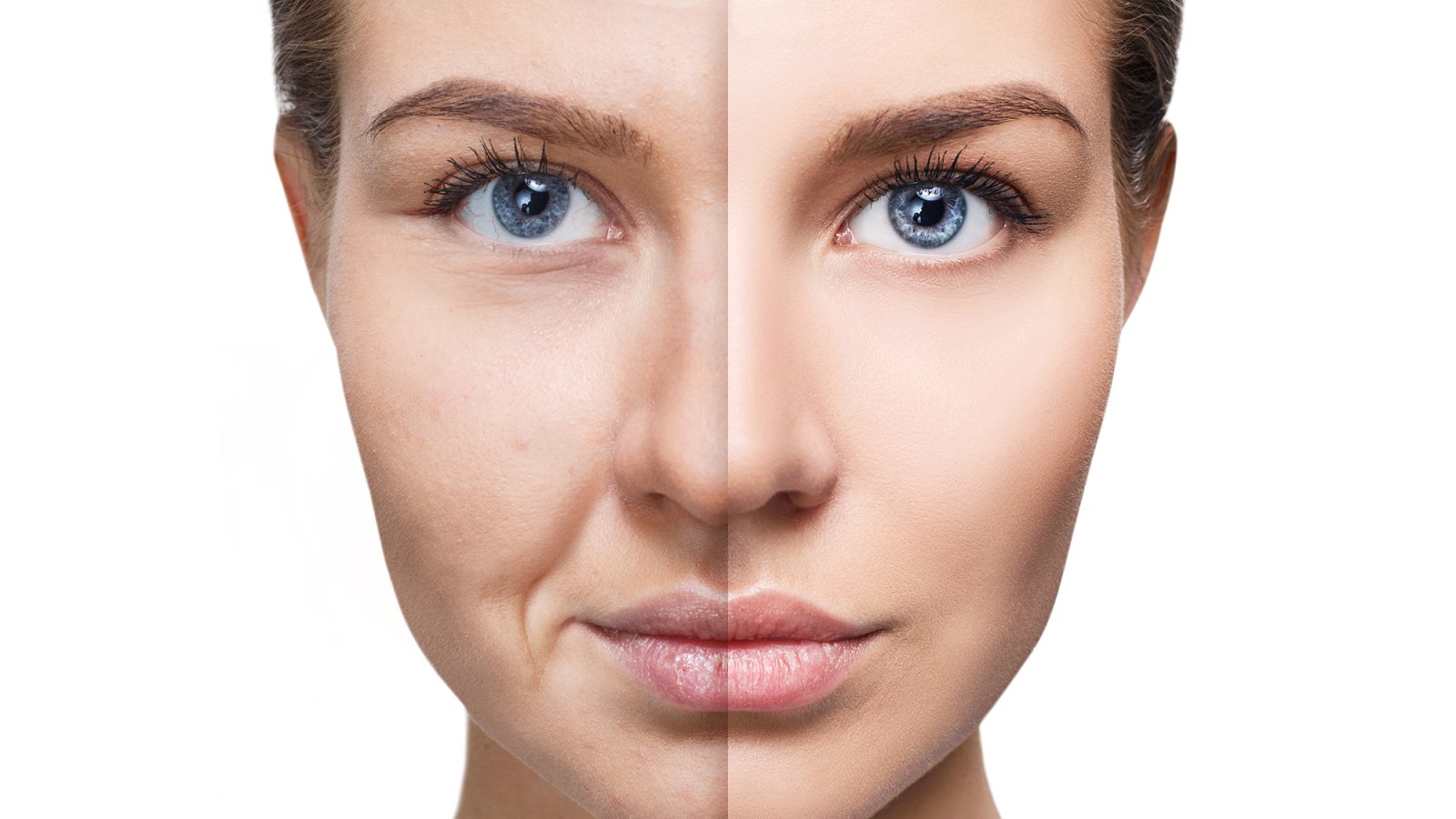 Dull-Skin-Before-After-Stock-Photo