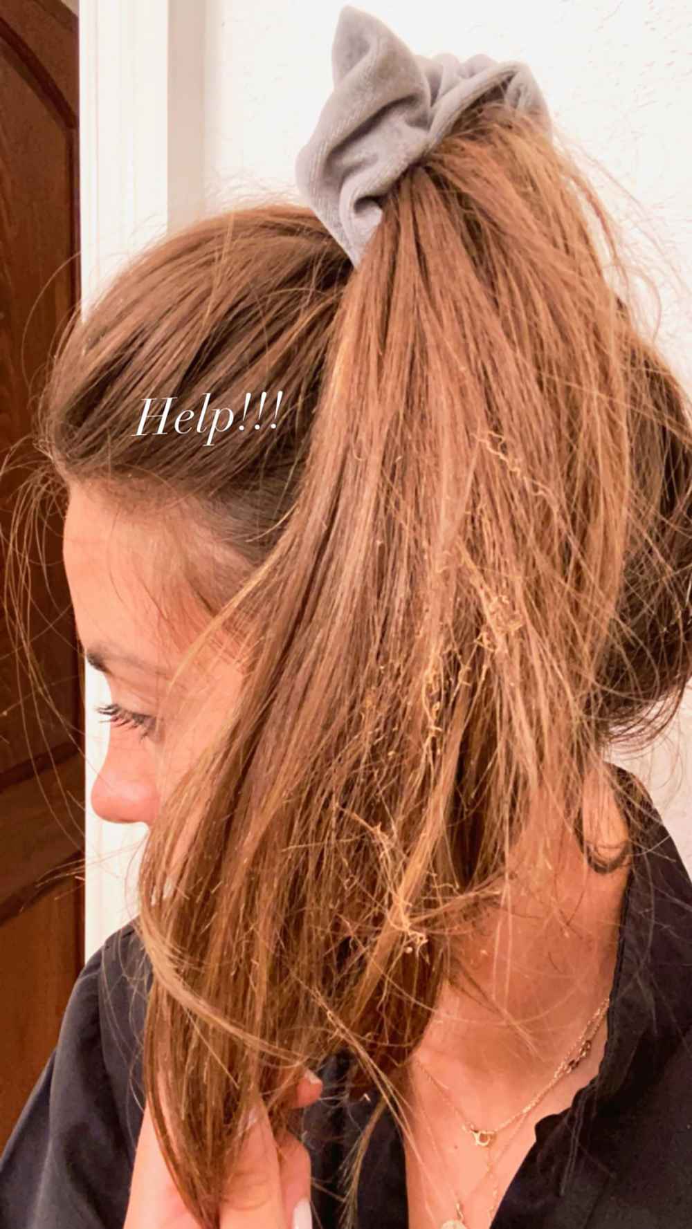 The Bachelor’s Kelley Flanagan Accidentally Sets Her Hair on Fire: Pics