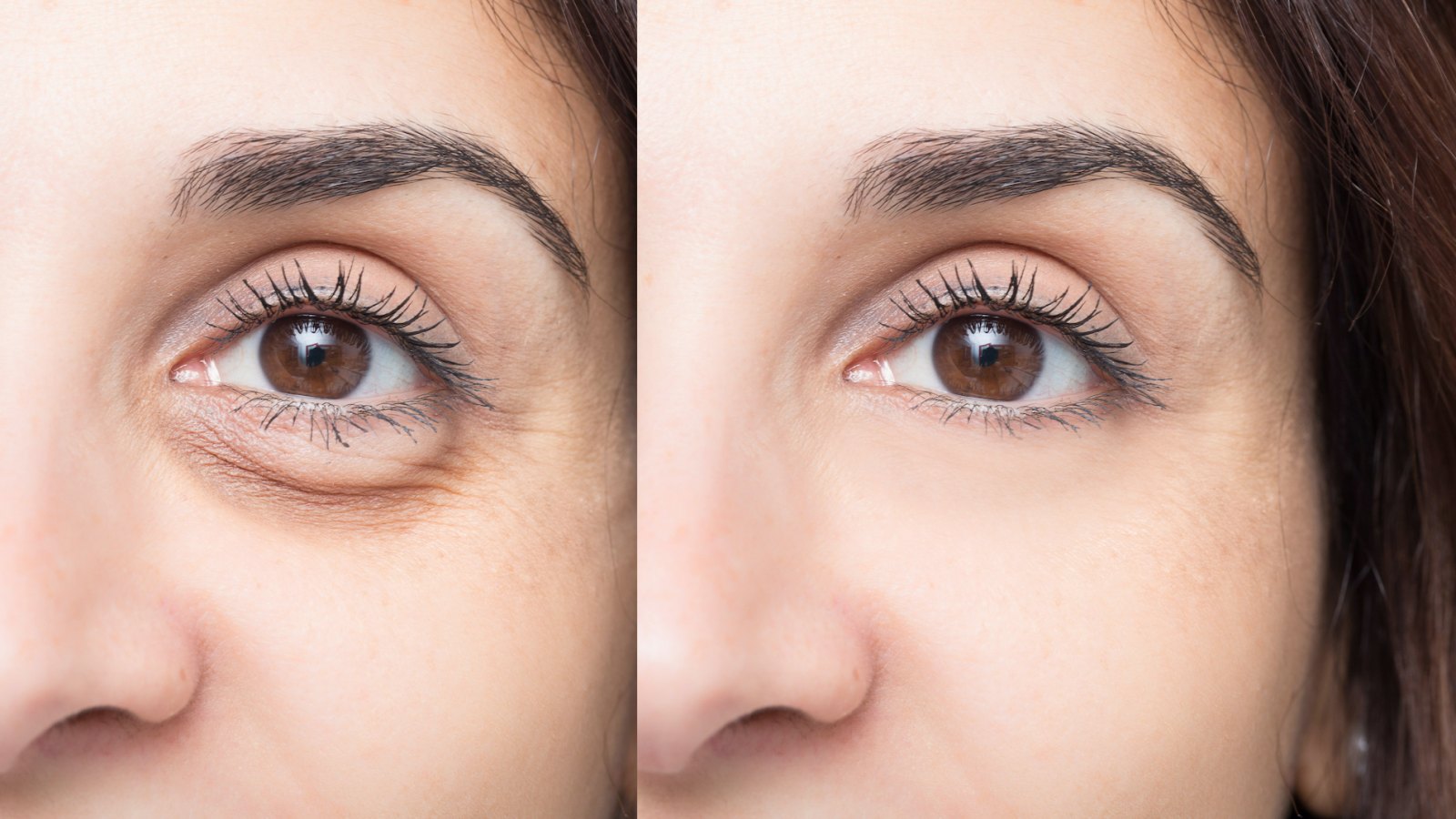 Puffy-Eyes-Before-After-Stock-Photo