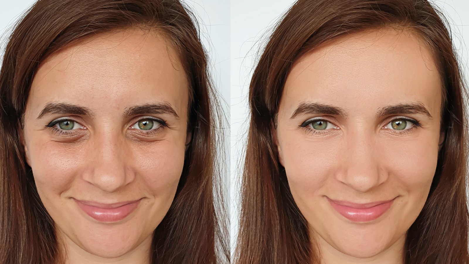 Before-After-Eyelift-Beauty-Shot