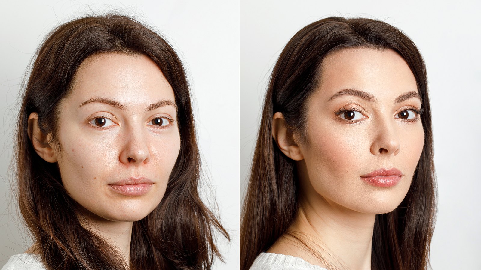 before-after-skin