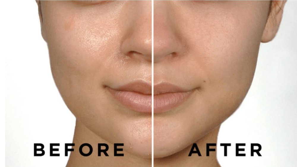 meditime-pore-tightening-mask-before-after