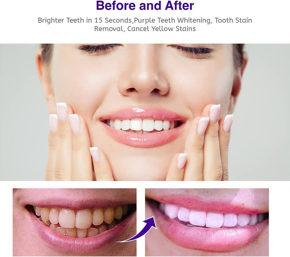 nolipem-teeth-whitening-foam-before-after