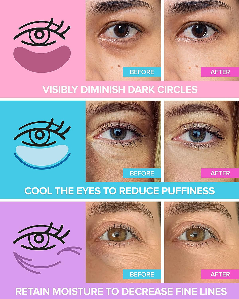 amazon-maree-eye-gels-before-after