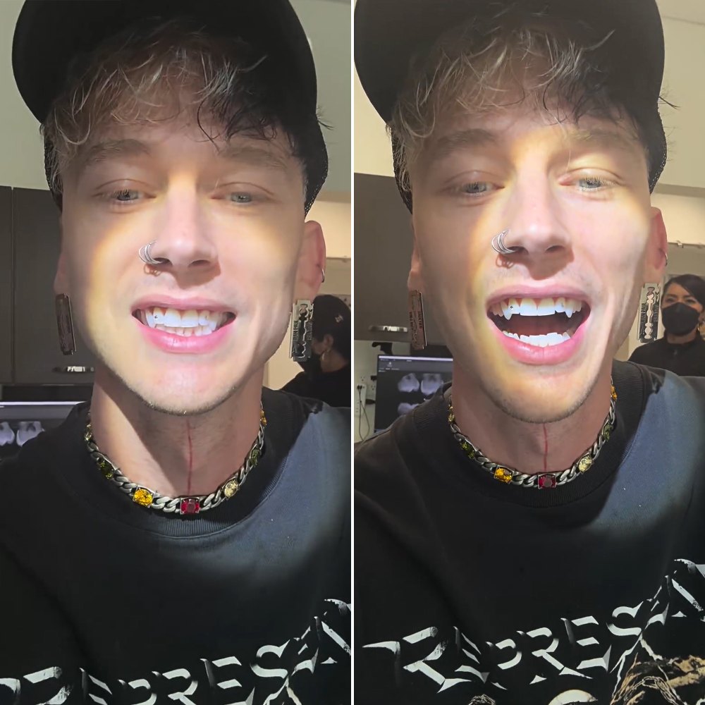 Machine Gun Kelly Shows Off New Fangs