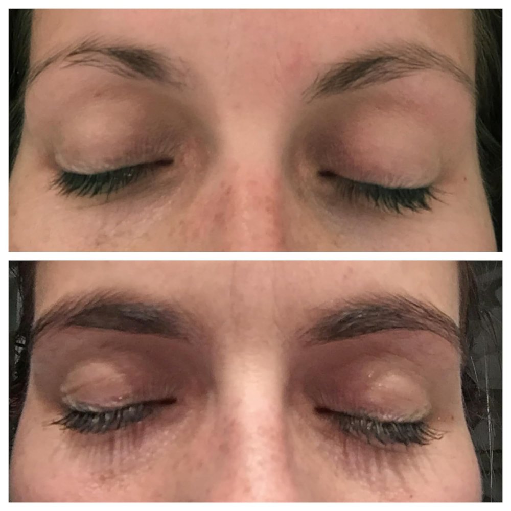 eyebrow-serum-before-after